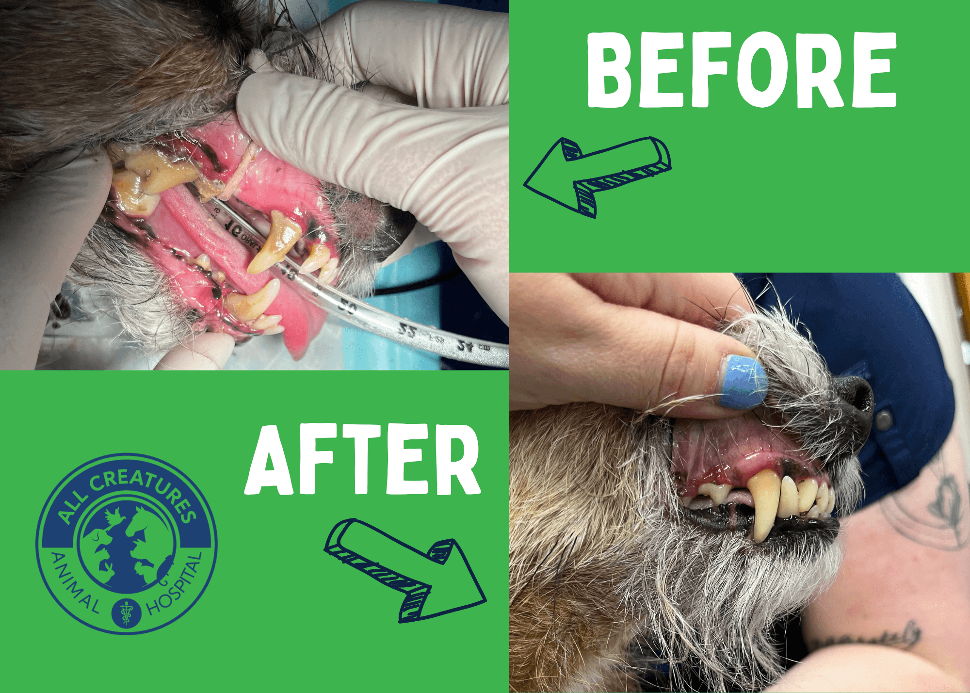 Before and After of Ultrasonic Scaling Dental Cleaning